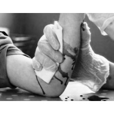 Article | How to Stop Bleeding | Managing Injuries in Martial Arts Training | By Thomas Richard Joiner  |  如何止血